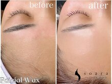 ソアラ(soara)の雰囲気（お肌のザラつきがなくなりモチッとした艶肌へ♪美肌ワックス脱毛）