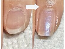 ゴッダスネイル(GODDESS NAIL)の雰囲気（地爪育成コースのお客様の3ヶ月の変化です！お悩みご相談下さい）
