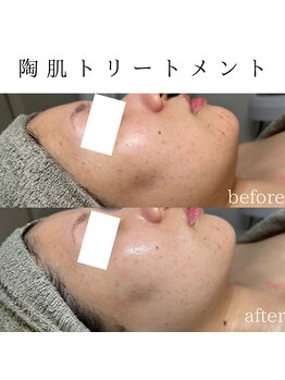 ビューティービューティー(BEAUTY BEAUTY)/