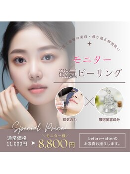 オアシスサカエ(OASIS SAKAE)/【復元磁気ピーリング】