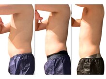 サロンドモフィ(salon de moffy)/痩身【脂肪冷却】おなか施術例５