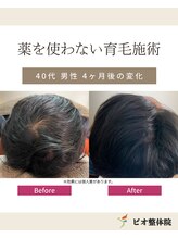 コレア整体院(COREA整体院)/ 再生育毛促進術