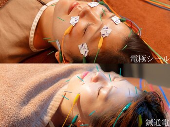 カラダキュア 東京銀座の写真/カラダキュアは美容鍼だけじゃない!電気美容鍼/小顔矯正/お顔リンパ/アイヘッド/美容灸などで満足度◎