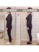 シェア 人形町店(Chare)/【小顔・骨盤矯正・О脚・整体】