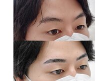 クール(COEUR)/スタンダードコース