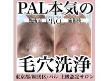 パル(PAL)