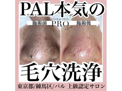パル(PAL)の写真