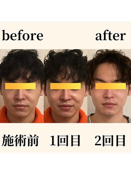 ロータス ビューティー(LOTUS Beauty)/小顔/メンズ歓迎/フェイスライン