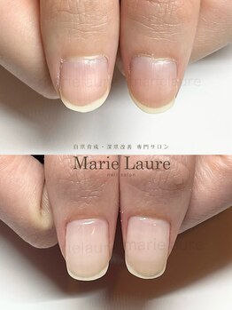 マリーロール 梅田店(Marie Laure)/深爪矯正/自爪育成/ネイルケア