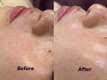 クイーン(QUEEN)/お肌の調子が悪い方