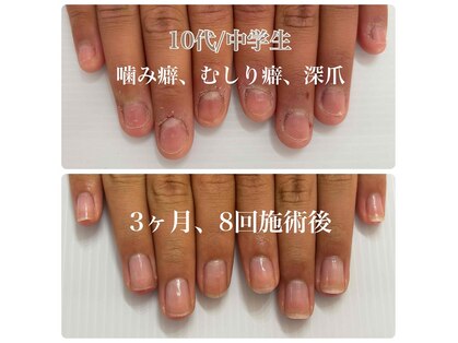 ネイルサロン ハヌル(Nail Salon Ha Neul)の写真