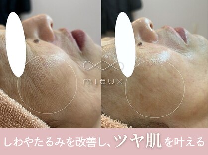 ミュー 自由が丘店(mieux)の写真