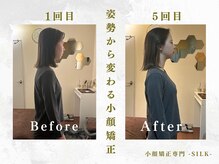 シルク(SILK)の雰囲気(Point 2 科学的根拠に基づく・姿勢から変わる輪郭・小顔矯正)