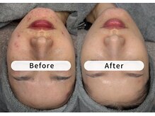 エミエル(EMIER)の雰囲気（大人の肌悩みに寄り添い、無理なく続けられる肌質改善サロン♪）