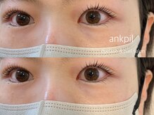 アノカプイル(ankpil)/【パリジェンヌラッシュリフト】