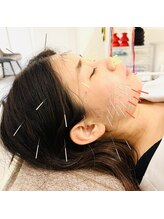 銀座鍼処 カナウ(KANAU)/美容鍼×ヘッドスパ鍼もできます