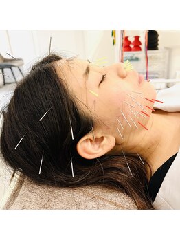 銀座鍼処 カナウ(KANAU)/美容鍼×ヘッドスパ鍼もできます