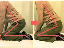 杉本接骨鍼灸院/効果も目に見えて分かって嬉しい