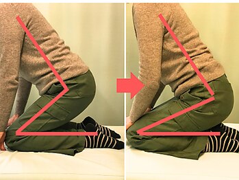 杉本接骨鍼灸院/効果も目に見えて分かって嬉しい