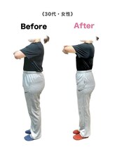 アンカーフィット(ANCHORFIT)/◆施術例◆産後ダイエット