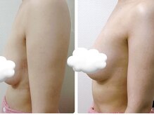 リボミュウ(Ribbomiu)の雰囲気（まずは3ヶ月コミット!変わると決めた人から変われる早い者勝ち★）
