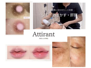 アティロン(Attirant)