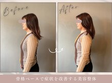 ほぐし屋 かすがい/猫背巻き肩矯正