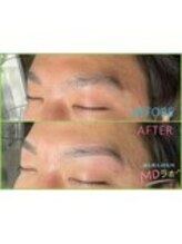 MDラボ 小松清六店/before after