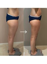 シュシュエステプリューム(Chou Chou Esthe PLUME)/