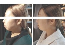 ペリドット(Peridot)/レモンボトル