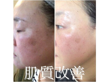 ビエタニティ(b.eternity)の写真