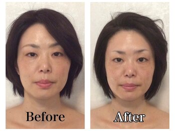 グレースフィオーレ 横浜店(gracefiore)/施術ビフォーアフター