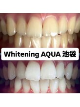 アクア 池袋店(AQUA)/ホワイトニング/池袋/東京/美白