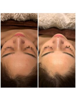 ビュウナ 銀座(BEAUNA)/シルクブライト