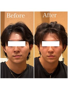 アキュレ(Acure)/