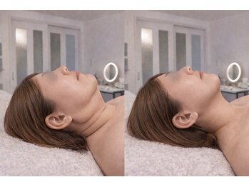 ドクターマジックタッチ(Dr.MAGIC TOUCH)の写真/もたつき顔・たるみ・二重あごに。脂肪分解剤導入の最強小顔ケア
