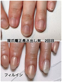 スマイルニコ(smile nico)/爪コンプレックス改善第一歩！