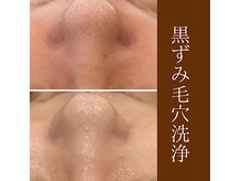 ファシル(Facile)の雰囲気（ハーブピーリング・REVI陶肌トリートメント）