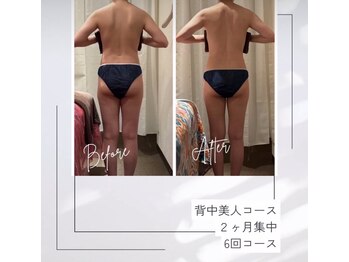 レムロード 赤羽店/ヒップアップ、太ももスッキリ!