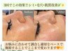 月1肌管理★Reviハーブピーリング(OP1種込)集中毛穴ケア1ヶ月以内の方¥19800