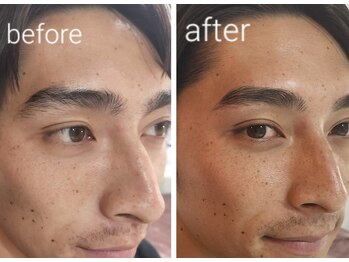 ビメ 中央林間(BEME)/before・after