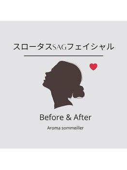 アロマ ソメイエ(Aroma Sommeiller)/【Before & After】
