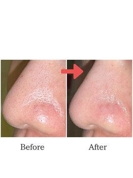 グラシア(gracia)/シミ・毛穴ケア専門店gracia