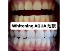 アクア 池袋店(AQUA)/ホワイトニング/池袋/東京/美白