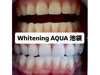 アクア 池袋店(AQUA)/ホワイトニング/池袋/東京/美白