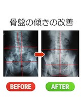 ヘンミ/骨盤矯正