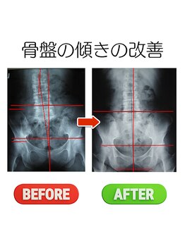 ヘンミ/骨盤矯正