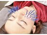 【美容鍼・幹細胞上清鍼コース】~お肌に特化した美容鍼★45分