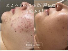 クレア(CLEA)/大人気の定額プランの魅力