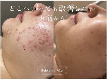 クレア(CLEA)/大人気の定額プランの魅力